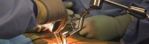 From CT Scan to Implant: Dr. Larry Davidson Details the Journey of Custom Spine Hardware
